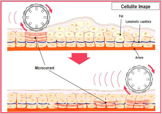 cells works to reduce cellulite